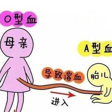 abo溶血是在肚子里就溶血吗